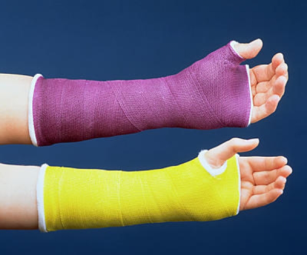 3M Scotchcast (kék) 5 cm x 3,6 m