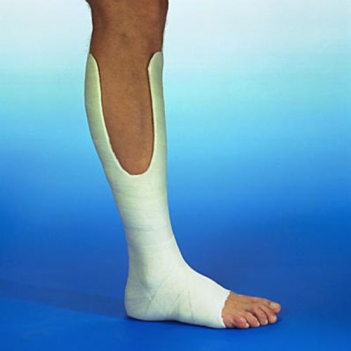 3M Soft Cast (fehér) 5 cm x 3,6 m