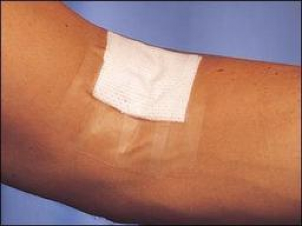 3M™ Tegaderm+Pad 5 x 7 cm